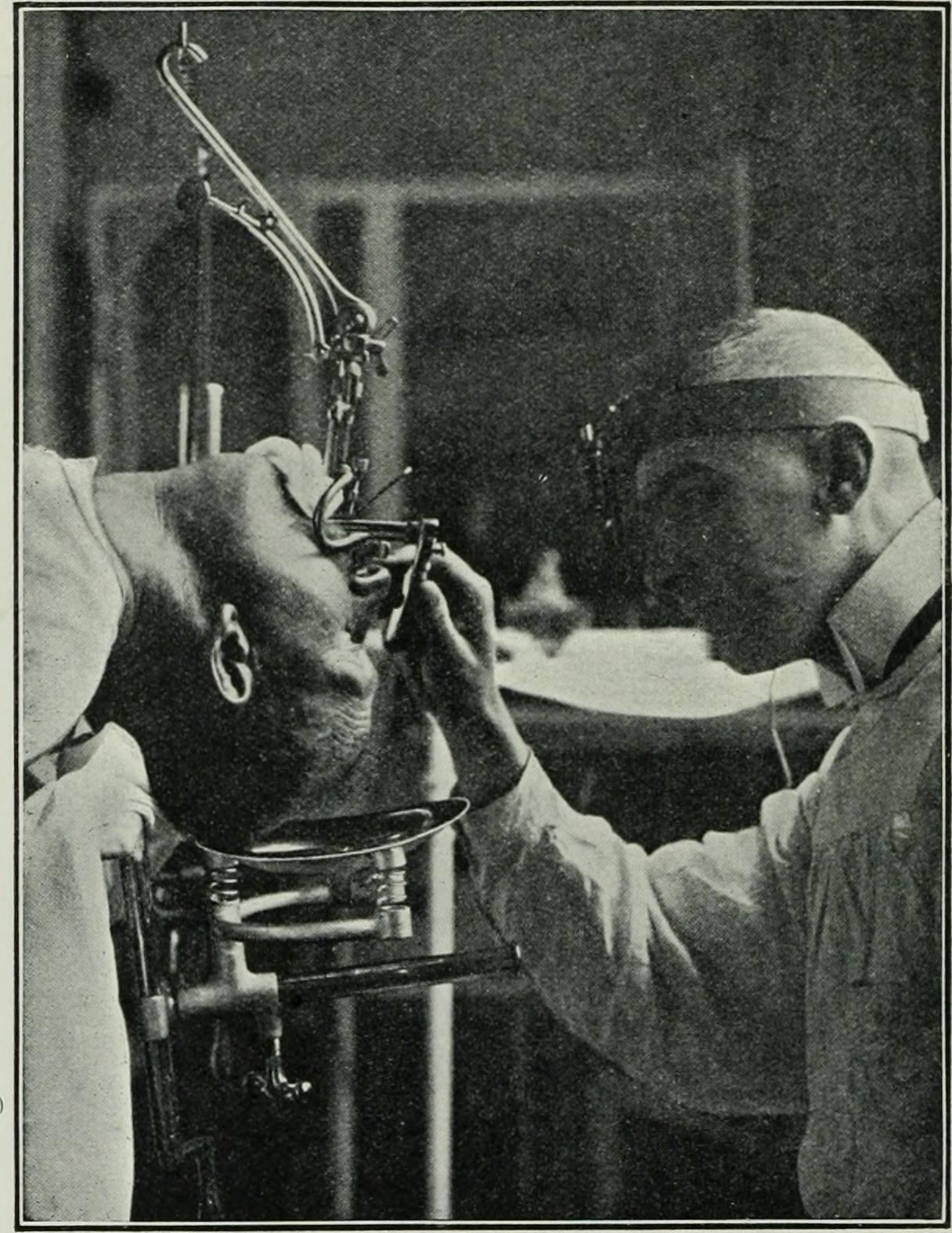 Ear Suction Pump