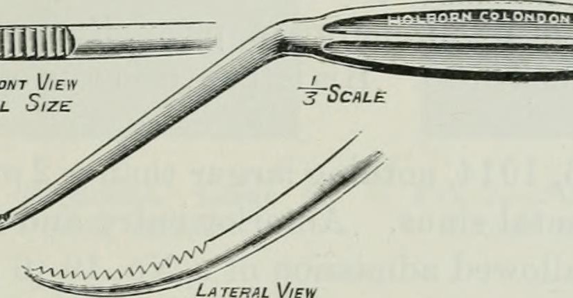 Suction Clearance of Keratosis Obturan Under General Anaesthesia