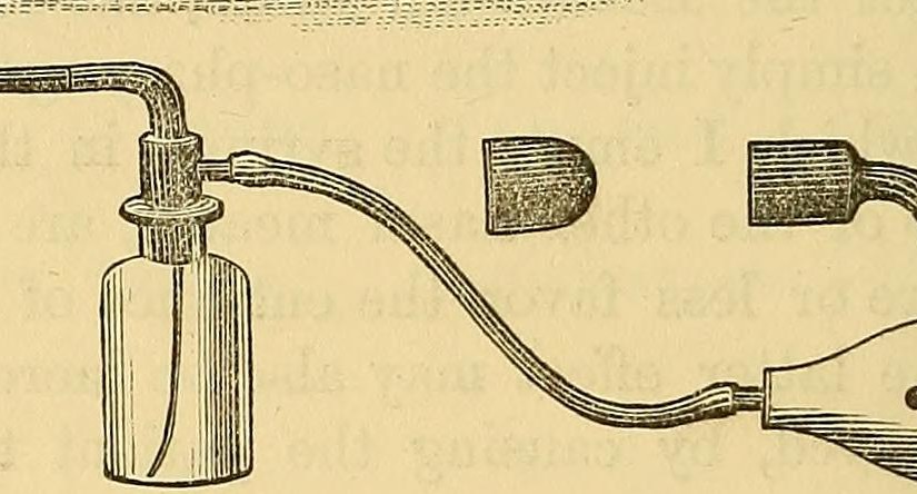 Ear Wax Irrigation DISGUSTING